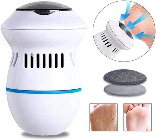 Removedor de callos eléctrico