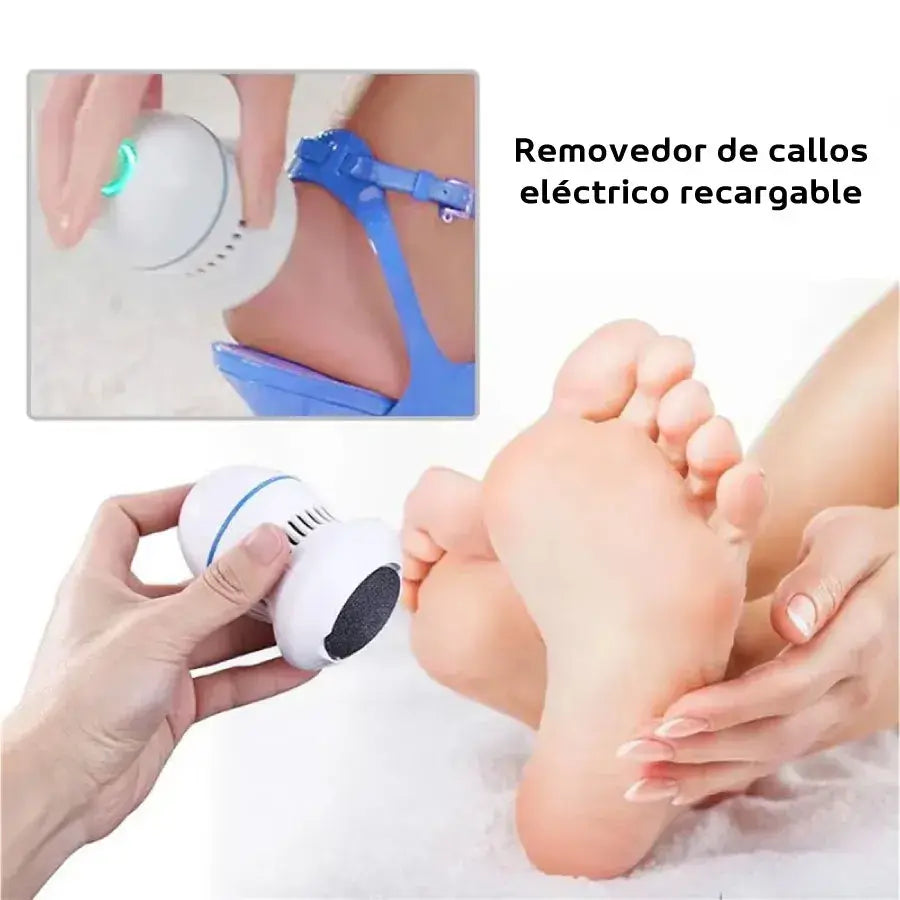 Removedor de callos eléctrico